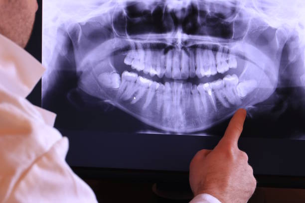 Best Emergency TMJ Treatment in Fox Chapel, PA